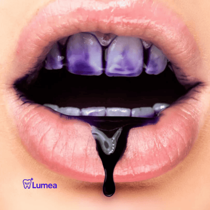 Lumea